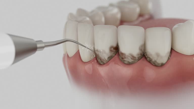 Reliable Dental Implants contractor in Raymond, IL by Smile Center Dentistry